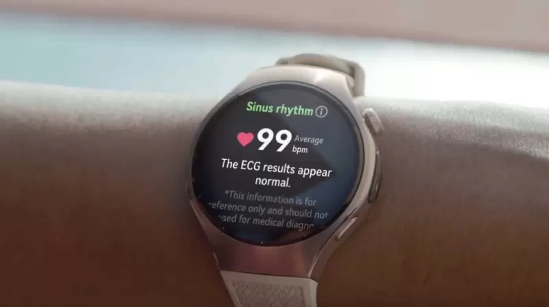 Huawei запустила предзаказ Watch 5: раскрыты цены и варианты корпусов